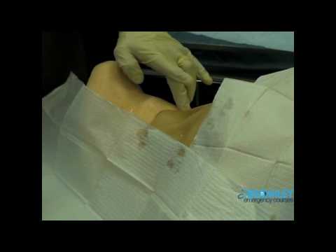 Central Line Jugular procedure by Bromley Emergency Courses