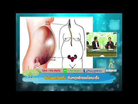 ผู้ชายยื่นวิดีโอผู้หญิง วิดีโอเชื้อโรคม้า