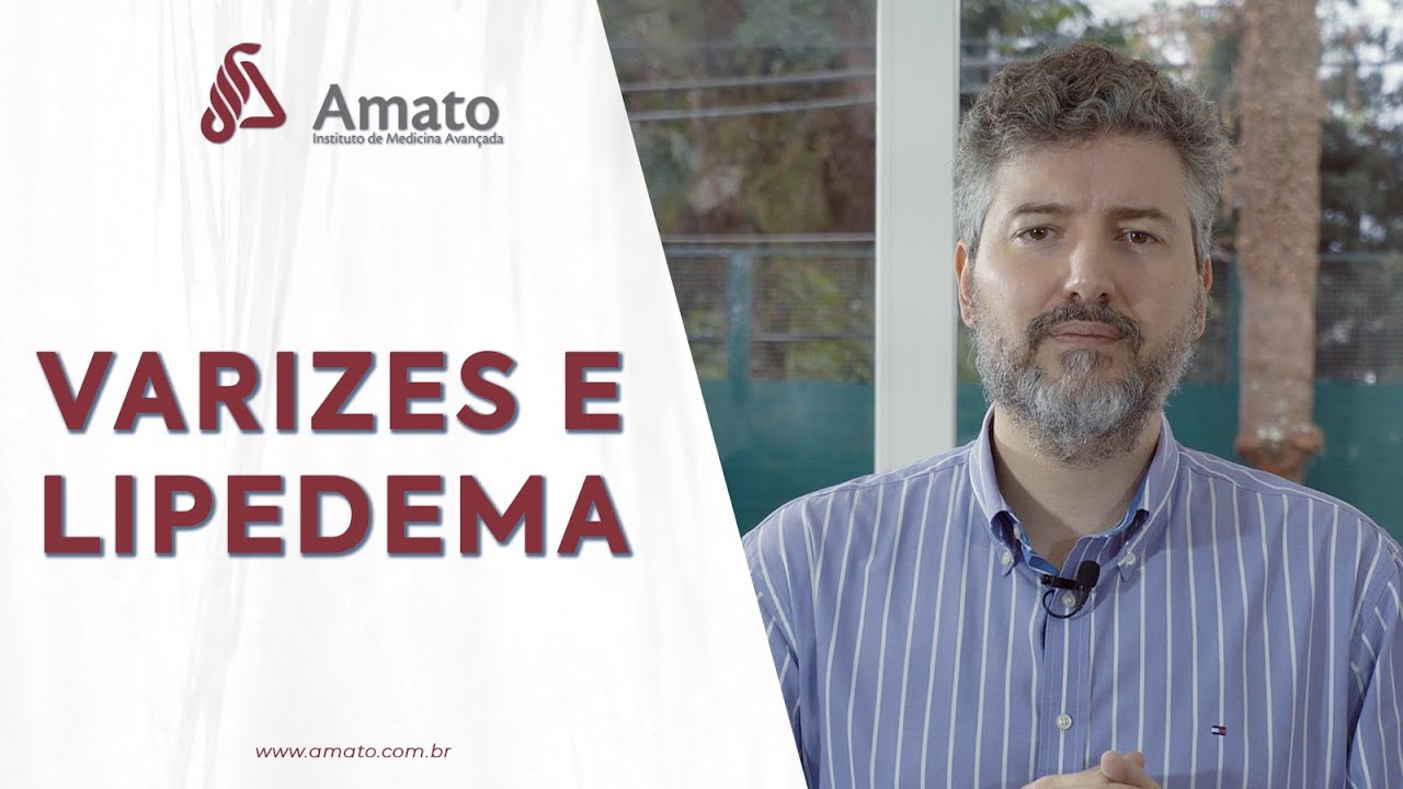 Varicose veins and Lipedema: poor venous circulation in lipedema