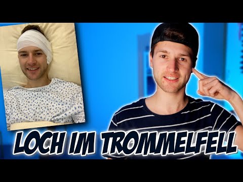 Loch im Trommelfell (Tymnoplastik), Operation - VLOG (tägliche Updates)