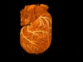 Rat heart 3D x-ray Australian Synchrotron IMBL ...