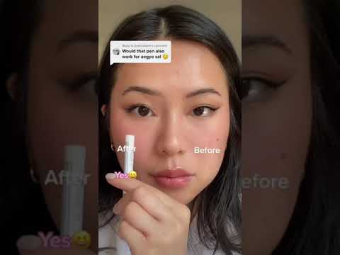 What is aegyo sal? 😳