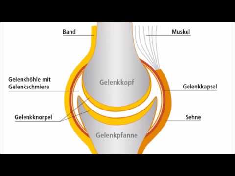 Wie behandelt Vorsprung der Halswirbelsäule werden Balsam für die Gelenke PS Verpackung