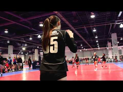 SB 15 White vs AIVC 15s