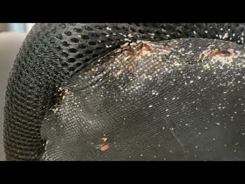 Desk Chair Full of Bed Bugs in Allenhurst, NJ