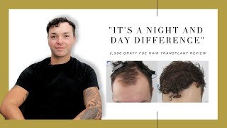 Canadian Hair Transplant Centre