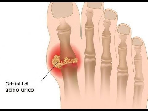 Il costo della protesi articolare a Mosca Farmaco cisti spinale