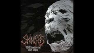 SKINLESS - Crispy Kids [Live]