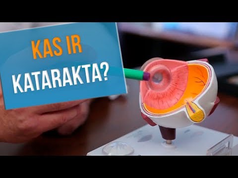 KAS IR KATARAKTA?