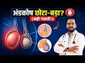 अंडकोष छोटा बड़ा क्यों हो रहा है Hydrocele Varic