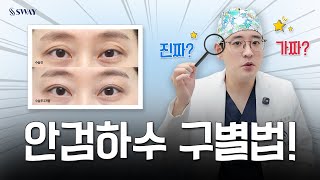 수술 전 꼭 보세요! 안검하수, 진짜 vs 가짜 구별법 #강민석대표원장 | SWAY