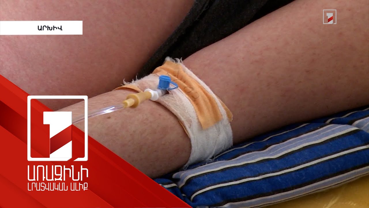 2024-ին Հայաստանում կարմրուկի 11 դեպք է գրանցվել. 2-ը հոսպիտալացվել են