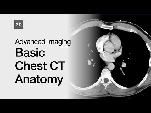 Advanced Imaging: Basic Chest CT Anatomy