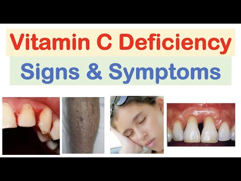 Vitamin C Deficiency Signs & Symptoms, Consequences (& Why They Occur)