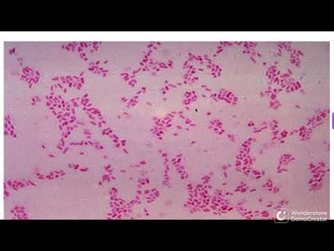 ANAEROBIC BACILLI BACTEROIDES  FUSIFORM