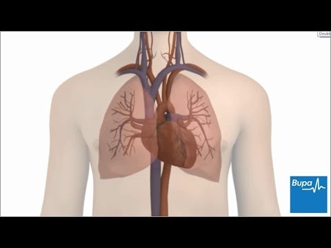 心臓の不整脈の種類 (The different types of heart arrhythmia)