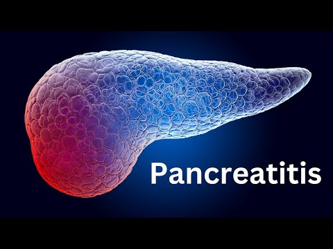 Pancreatitis: Everything You Need To Know