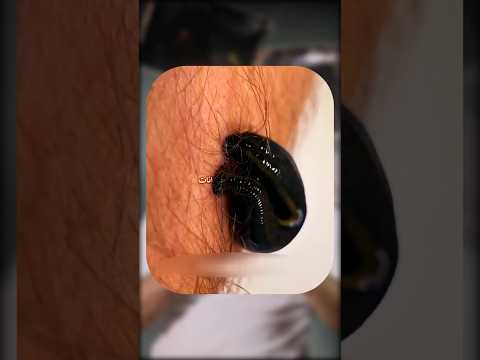 لو شفت الدودة دي اوعى تشدها! 😳🪱