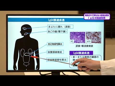 看護学科 20240420 『IgG4関連疾患』 血液・リウマチ膠原病科：川野 充弘 教授