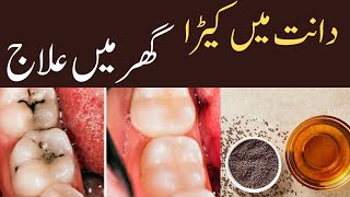 How To Get Rid Of Tooth CAVITY to Cure Tooth Pain at Home