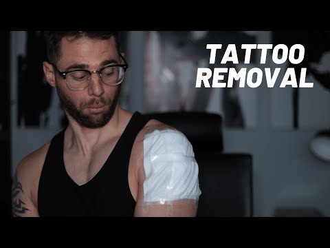 My Laser Tattoo Removal Experience | UPPER ARM, Pain, Cost and WHY I'm removing it!