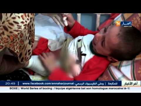 هيرشبرنغ مرض يحرم رامي من لذة الحياة