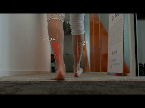 Ochy back view analysis for pronation & supination