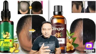 7 DAYS VIAVIC GINGER hair OIL vs GERMINAL GINGER hair REGROW SERUM ( IN ENGLISH )