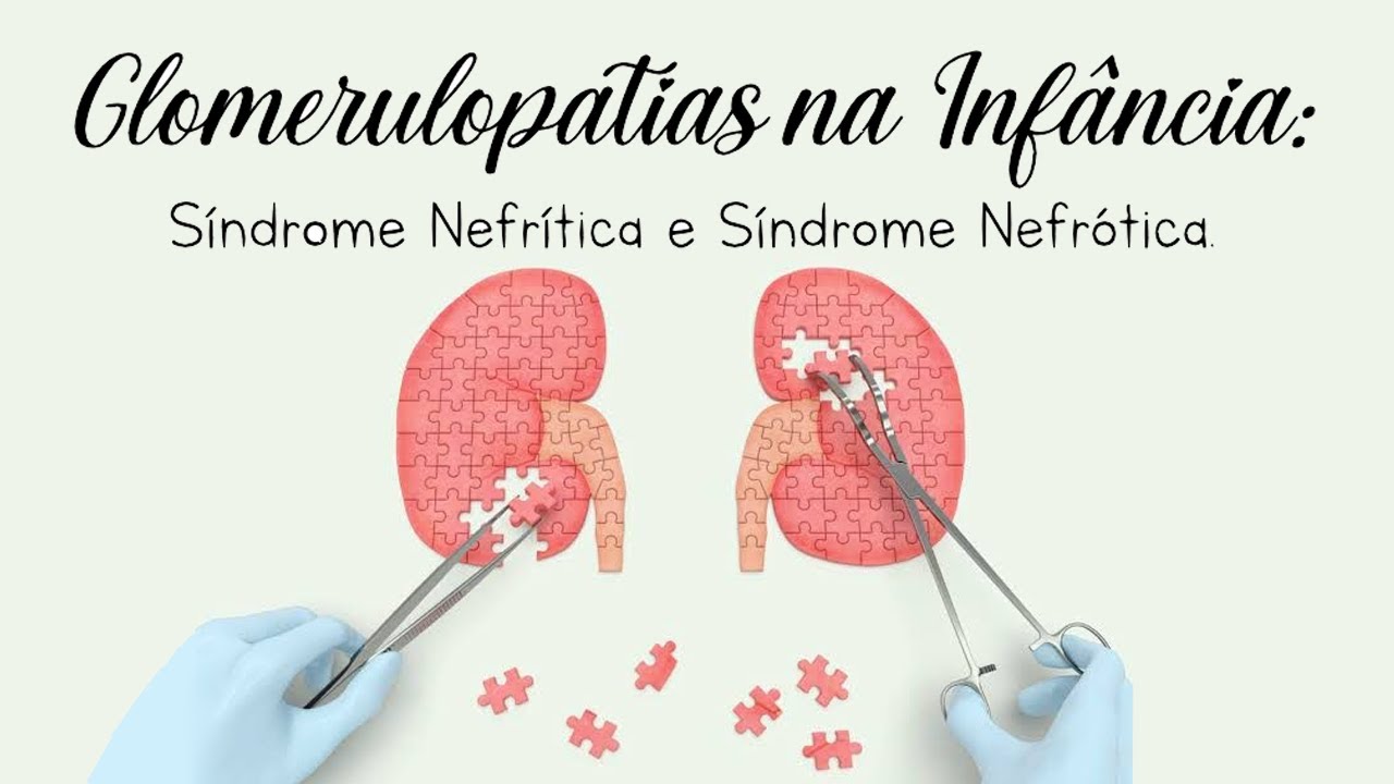 Glomerulopatias na Infância (Síndrome Nefrítica e  Síndorme Nefrótica)