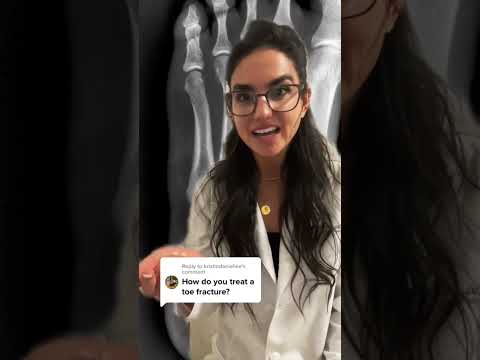 How toe fractures are treated