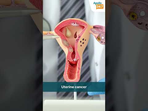 How To Deal With PCOD Acne Dr Koushik Lahiri