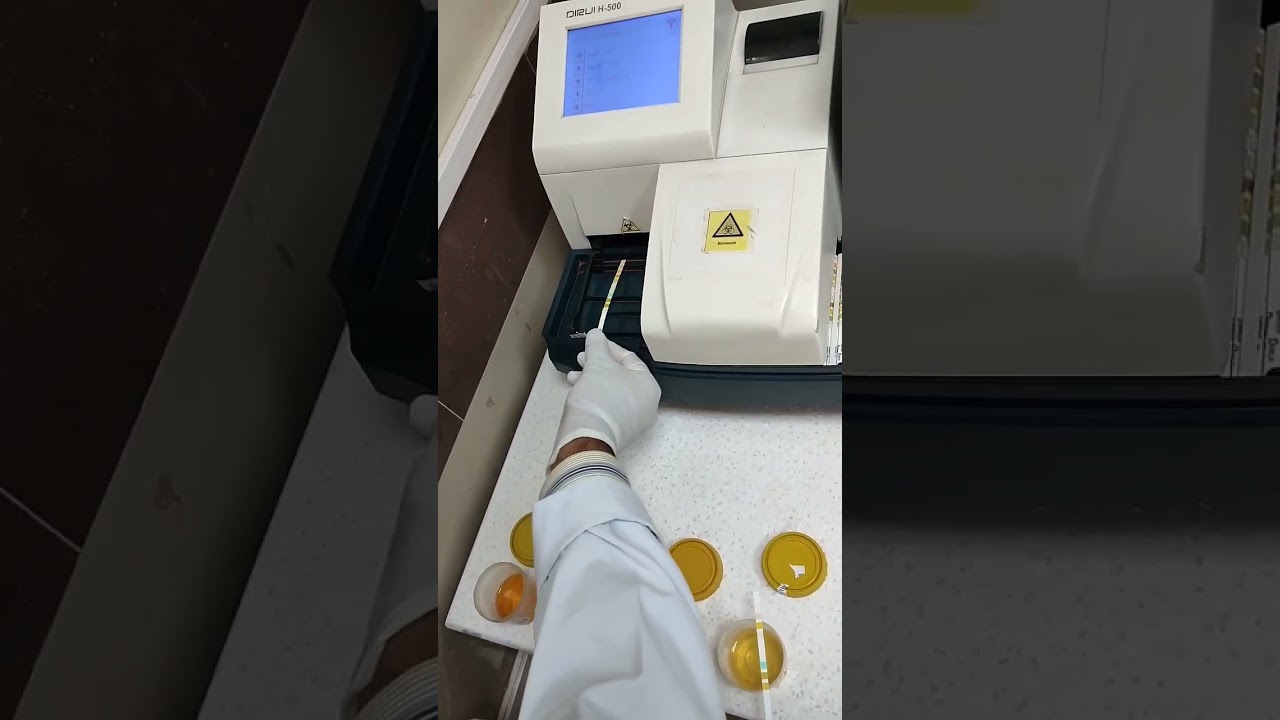 Semi Automated DIRUI-H 500/urine Examination/Routine Urine Analysis #mlt #shortvideo #youtuber
