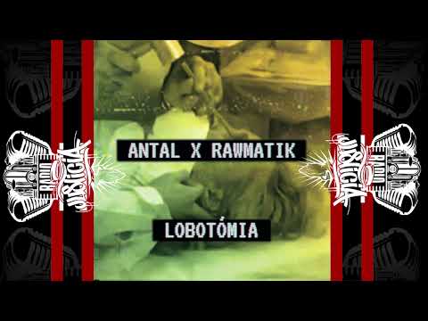 Antal x Rawmatik – Lobotómia (2021)