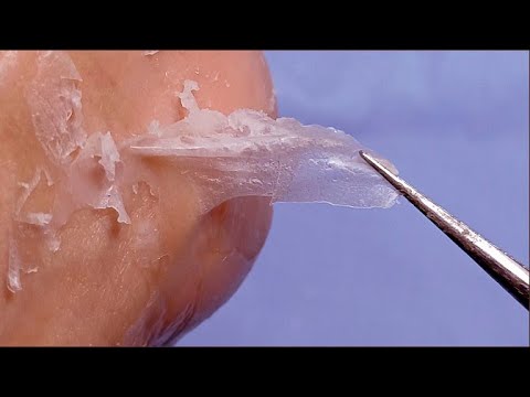 [ASMR] #皮肤刮刀 | Callus Peeling | Get Rid of Damaged Hand Skin! #Satisfying
