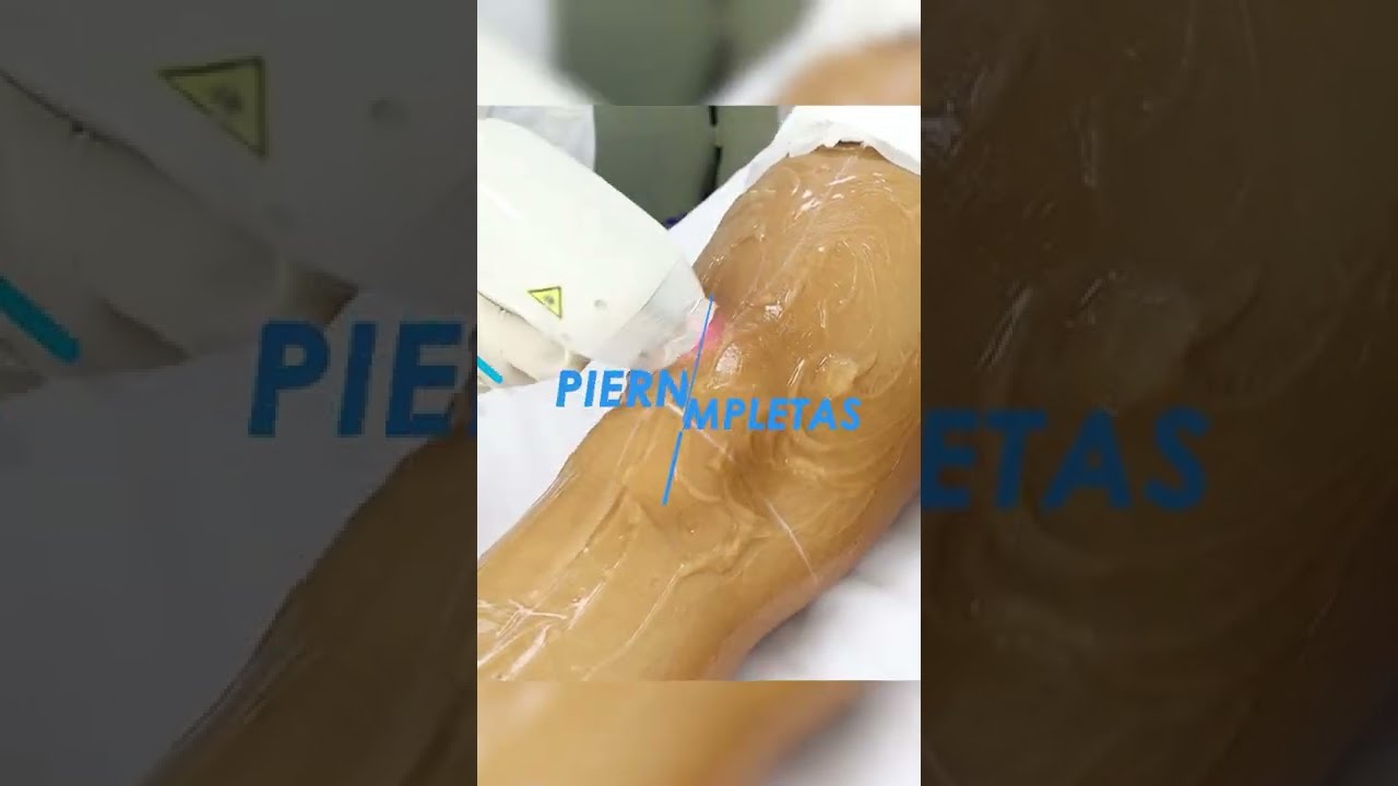 Watch ⬇️ CUANTO DURA DEPILACION LASER DIODO 😱 😱 PIERNAS Now ⬇️ CUANTO DURA DEPILACION LASER DIODO 😱 😱 PIERNAS