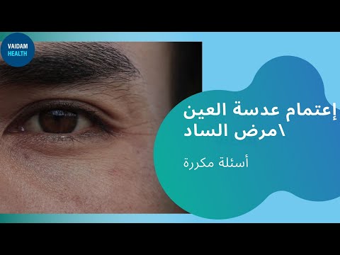 الأسئلة المتداولة حول الساد