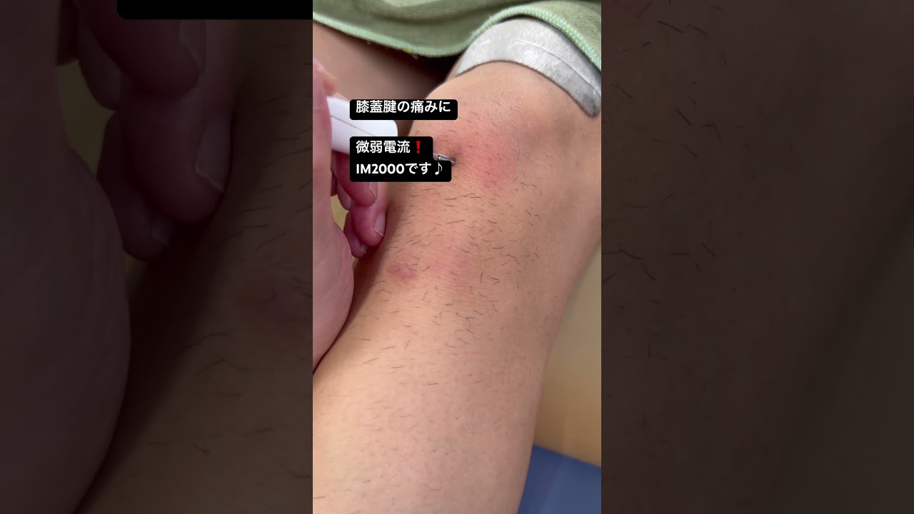 膝蓋腱症（ジャンバーズニー）に微弱電流、IM 2000