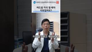 여드름 압출 후 자국과 상처의 자외선·보습 관리