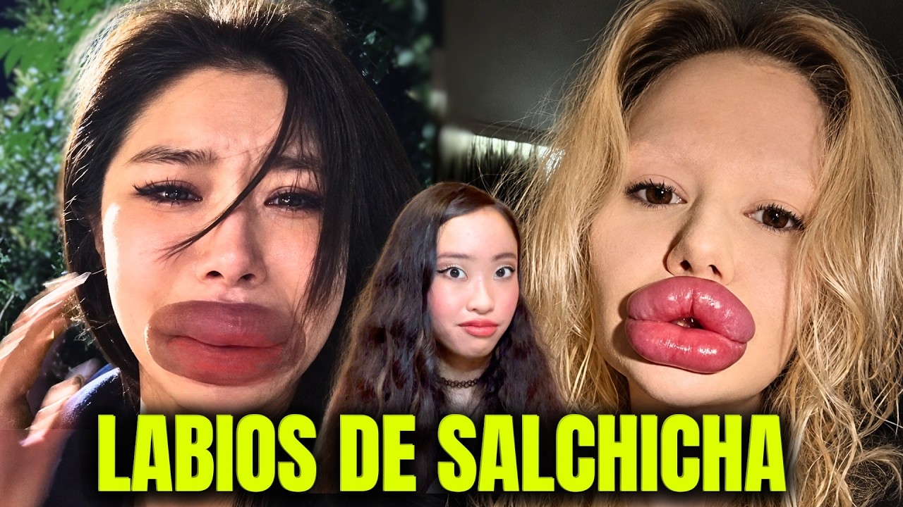 Se inyectan los LABIOS durante años... y el relleno NO DESAPARECE