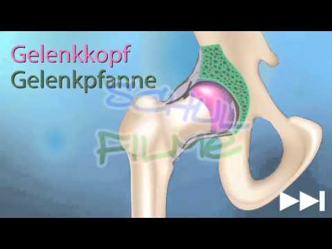 Schmerzen im Unterleib und senken in der 14. Woche der Schwangerschaft zurück Schwindlig krank Schwäche Bauchschmerzen Taille