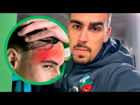 You WON'T BELIEVE the Brutal Attack My Player Suffered in the Game