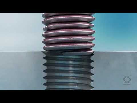 HeliCoil Screw Lock Inserts