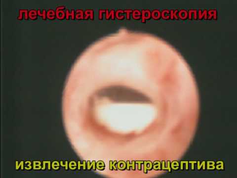 Грудной отдел позвоночника прямой упражнения Опух сустав после вывиха что делать