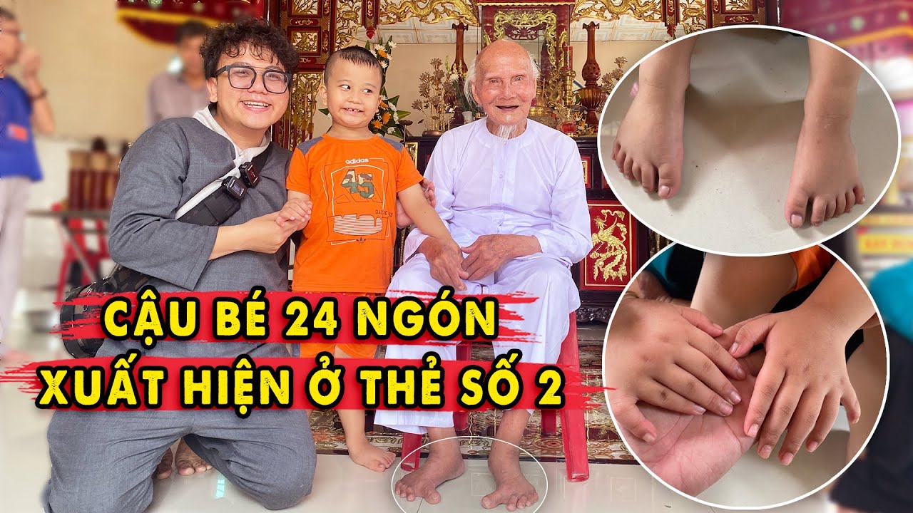 CẬU BÉ 24 NGÓN Hội Ngộ Cụ 100 Tuổi Có BÀN CHÂN GIÁO CHỈ
