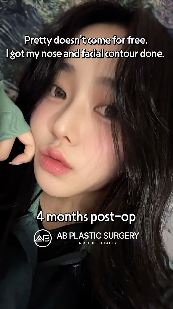 Nose+Jawline Surgery Changed Her Entire Face
