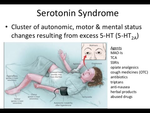 Serotonin Syndrome