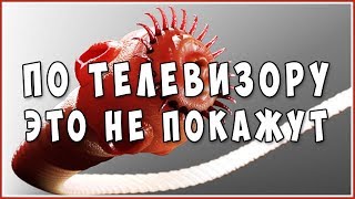 Паразиты. Глисты. Гельминты в организме человека. Жизненно важно знать всем! Смотрите!
