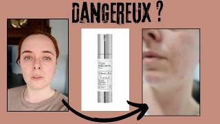 REEDLE SHOT 100 est-il DANGEREUX ? ⚠️ j'ai testé ... Viral KBeauty Skincare