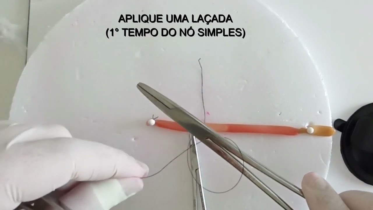 Técnicas cirúrgicas para Ligaduras