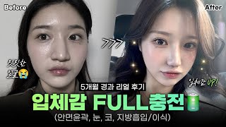 [리얼모델 VLOG] 입체감 FULL충전｜안면윤곽, 눈, 코, 지방흡입/이식 #일퍼센트성형외과